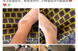 开云APP-足球明星张继科将伤退的简单介绍